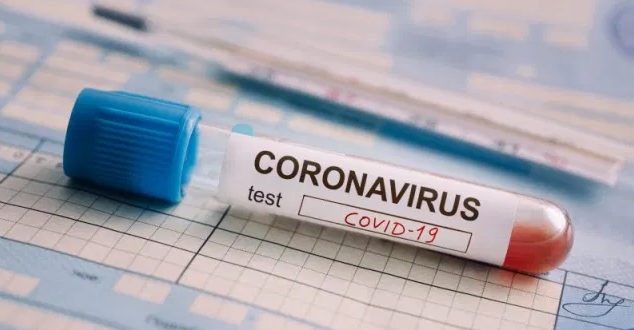 Հաստատվել է կորոնավիրուսային հիվանդության 745 նոր դեպք: Ունենք 427 առողջացած