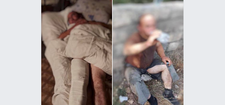ԱՀ. Գերի ընկած արցախցուն ադրբեջանցիները խոշտանգել ու բռնության են ենթարկել